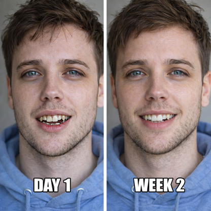 VYLA | Dentite Tooth Armor