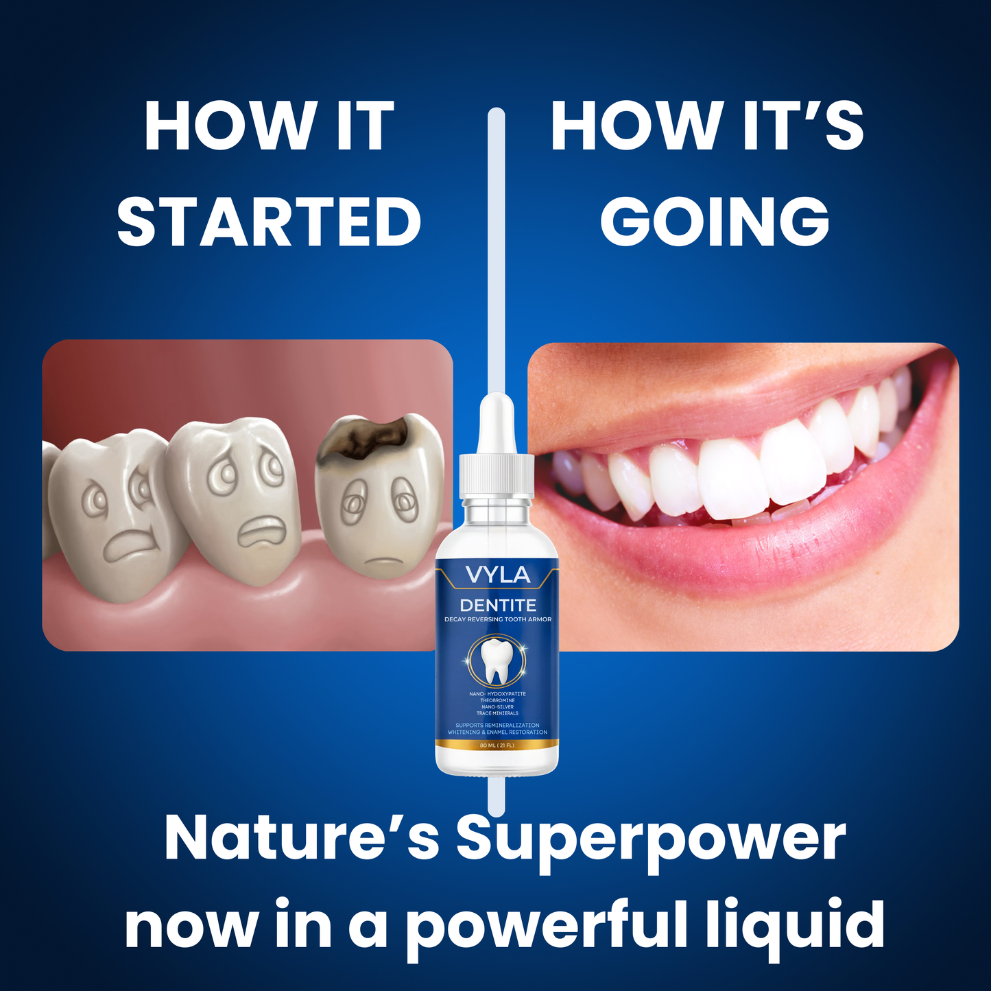 VYLA | Dentite Tooth Armor